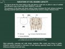 Modifying load bearing capacity of ground